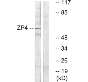 Western Blot - Anti-ZP4 Antibody (C19638) - Antibodies.com