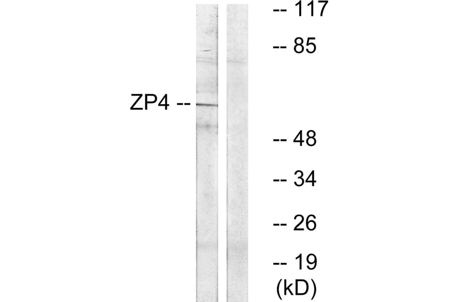 Western Blot - Anti-ZP4 Antibody (C19638) - Antibodies.com