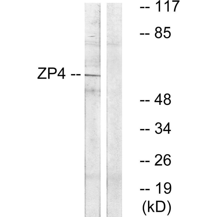 Western Blot - Anti-ZP4 Antibody (C19638) - Antibodies.com