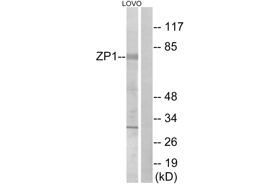 Western Blot - Anti-ZP1 Antibody (C19635) - Antibodies.com