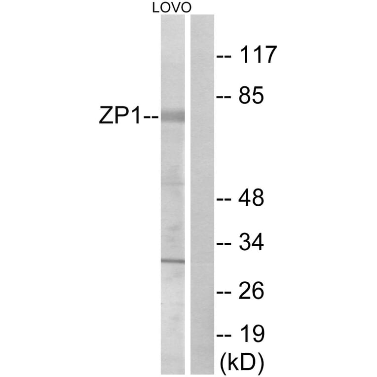 Western Blot - Anti-ZP1 Antibody (C19635) - Antibodies.com