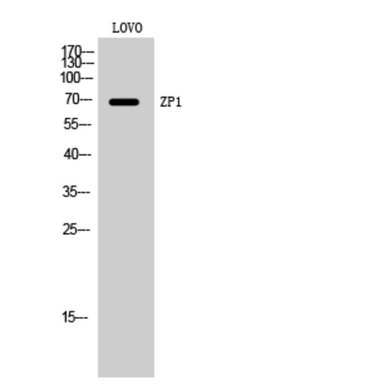 Western Blot - Anti-ZP1 Antibody (C19635) - Antibodies.com