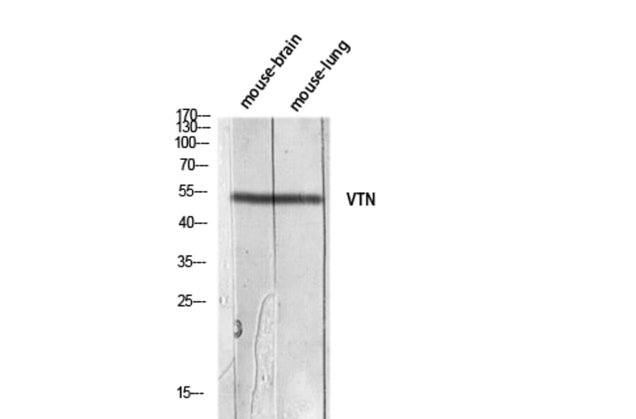 Western Blot - Anti-VTN Antibody (C30305) - Antibodies.com