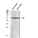 Western Blot - Anti-VTN Antibody (C30305) - Antibodies.com