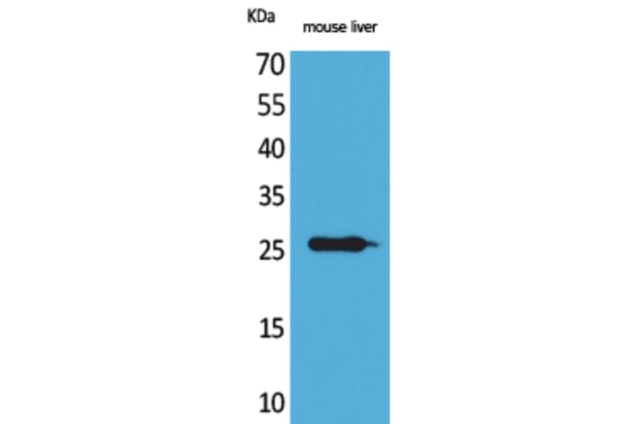 Western Blot - Anti-TNF Antibody (C30026) - Antibodies.com