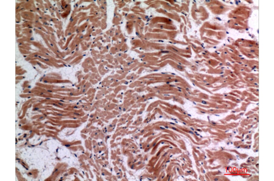 Immunohistochemistry - Anti-TNF Antibody (C30026) - Antibodies.com
