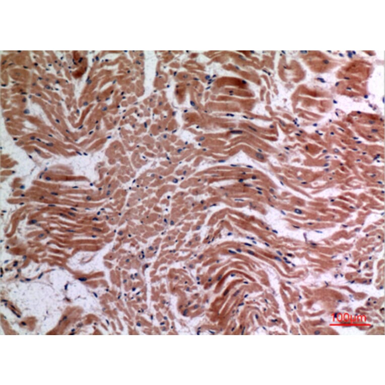 Immunohistochemistry - Anti-TNF Antibody (C30026) - Antibodies.com