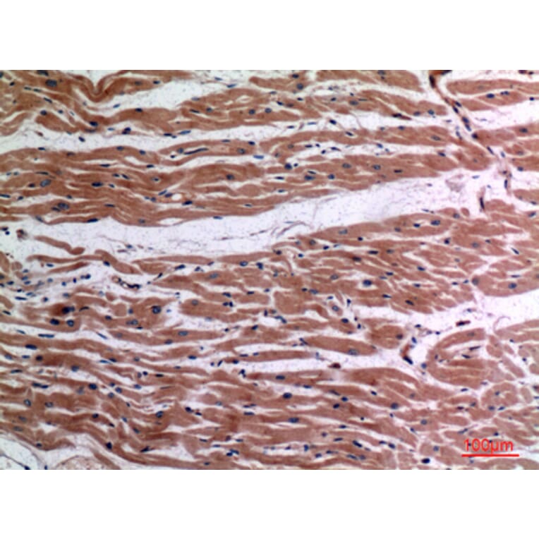 Immunohistochemistry - Anti-TNF Antibody (C30026) - Antibodies.com