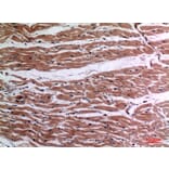 Immunohistochemistry - Anti-TNF Antibody (C30026) - Antibodies.com