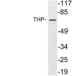 Western Blot - Anti-THP Antibody (R12-2381) - Antibodies.com