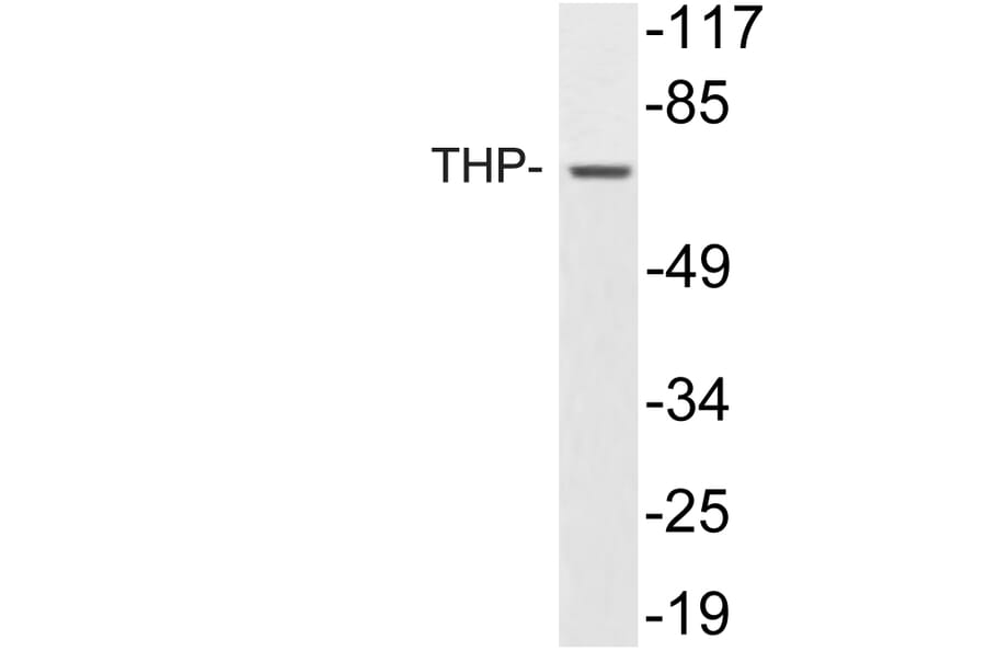 Western Blot - Anti-THP Antibody (R12-2381) - Antibodies.com