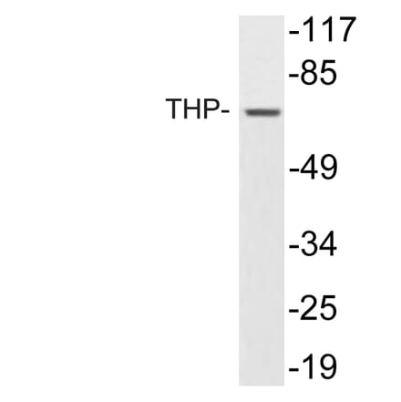 Western Blot - Anti-THP Antibody (R12-2381) - Antibodies.com