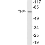 Western Blot - Anti-THP Antibody (R12-2381) - Antibodies.com