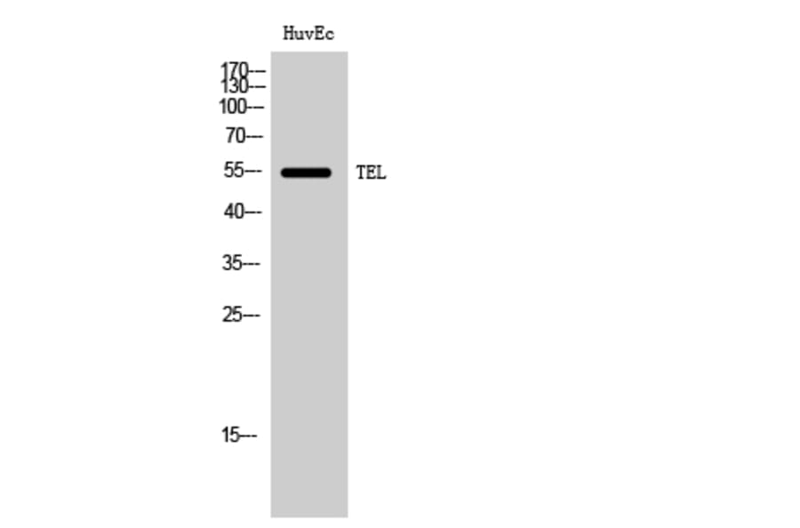 Western Blot - Anti-Tel Antibody (B8432) - Antibodies.com