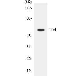 Western Blot - Anti-Tel Antibody (R12-3611) - Antibodies.com