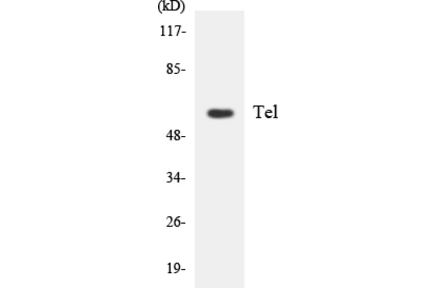 Western Blot - Anti-Tel Antibody (R12-3611) - Antibodies.com
