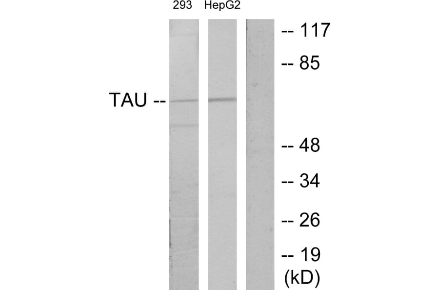 Western Blot - Anti-Tau Antibody (B7244) - Antibodies.com