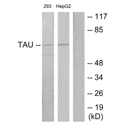Western Blot - Anti-Tau Antibody (B7244) - Antibodies.com