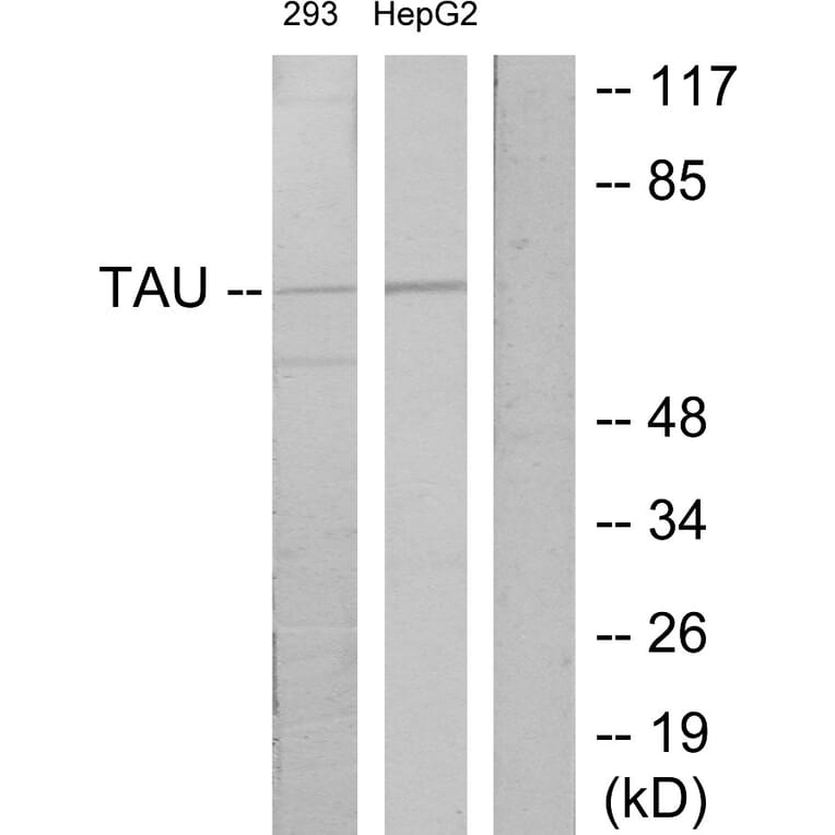 Western Blot - Anti-Tau Antibody (B7244) - Antibodies.com