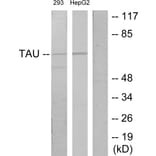 Western Blot - Anti-Tau Antibody (B7244) - Antibodies.com