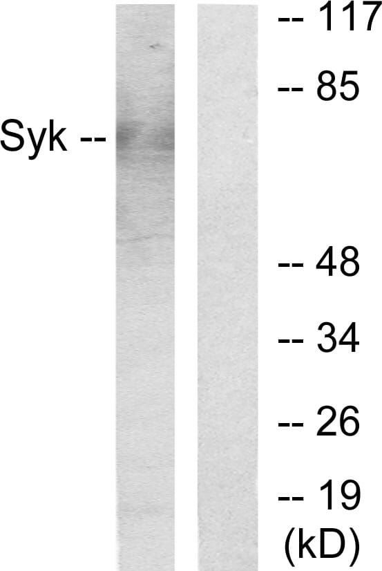 Anti-Syk Antibody [SYK-01] (A85858) | Antibodies.com