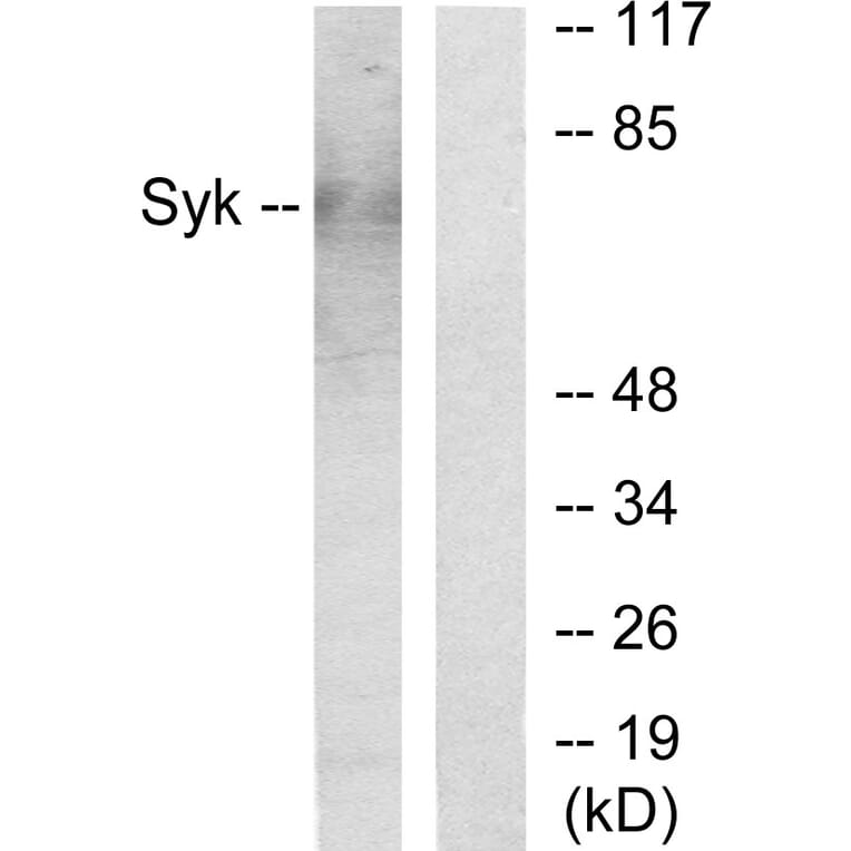 Western Blot - Anti-SYK Antibody (C0332) - Antibodies.com