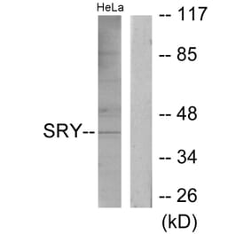 Western Blot - Anti-SRY Antibody (C10883) - Antibodies.com