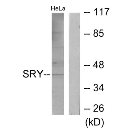 Western Blot - Anti-SRY Antibody (C10883) - Antibodies.com