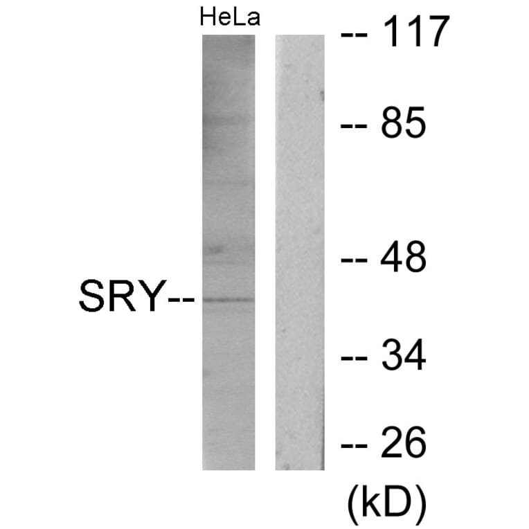 Western Blot - Anti-SRY Antibody (C10883) - Antibodies.com