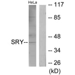 Western Blot - Anti-SRY Antibody (C10883) - Antibodies.com