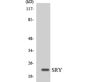 Western Blot - Anti-SRY Antibody (R12-3562) - Antibodies.com
