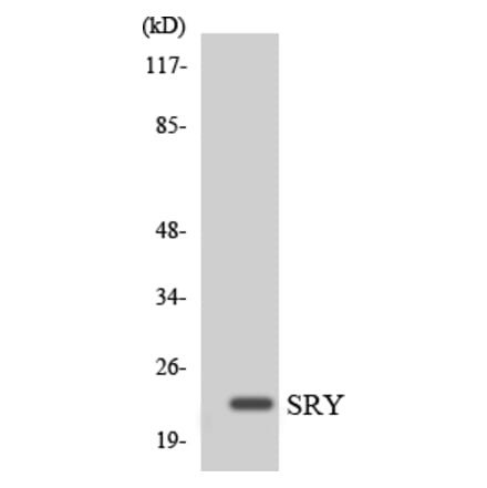 Western Blot - Anti-SRY Antibody (R12-3562) - Antibodies.com