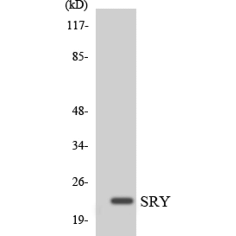 Western Blot - Anti-SRY Antibody (R12-3562) - Antibodies.com