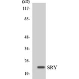 Western Blot - Anti-SRY Antibody (R12-3562) - Antibodies.com