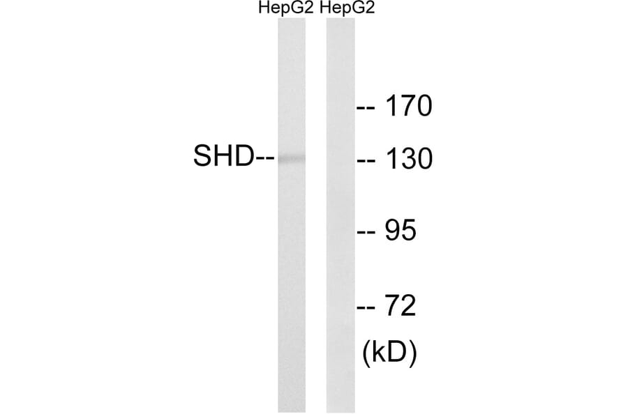 Western Blot - Anti-SHD Antibody (C18695) - Antibodies.com