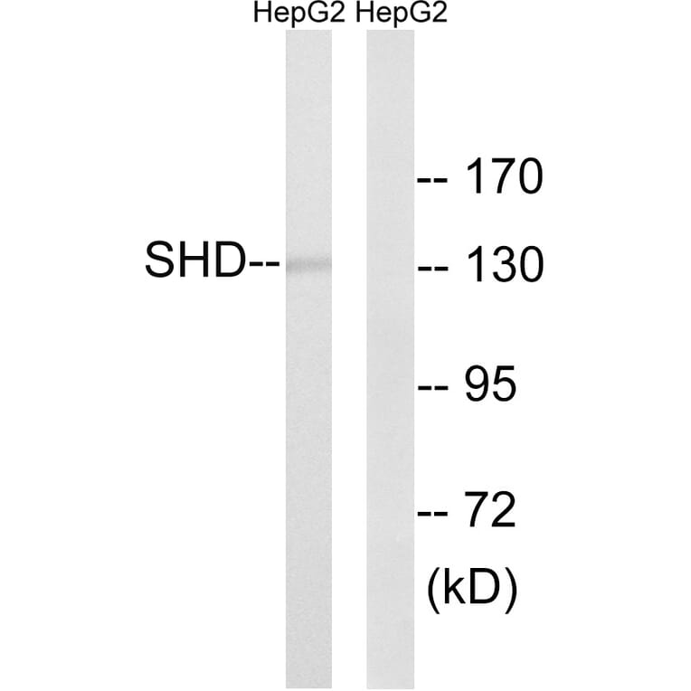 Western Blot - Anti-SHD Antibody (C18695) - Antibodies.com