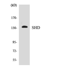 Western Blot - Anti-SHD Antibody (R12-3506) - Antibodies.com