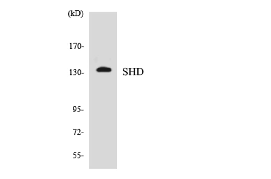 Western Blot - Anti-SHD Antibody (R12-3506) - Antibodies.com