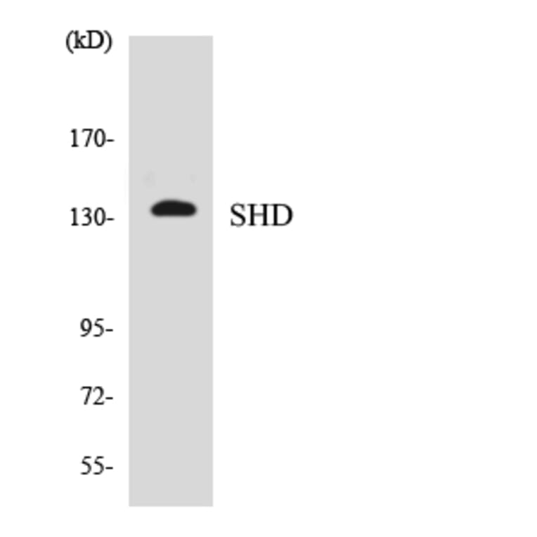 Western Blot - Anti-SHD Antibody (R12-3506) - Antibodies.com