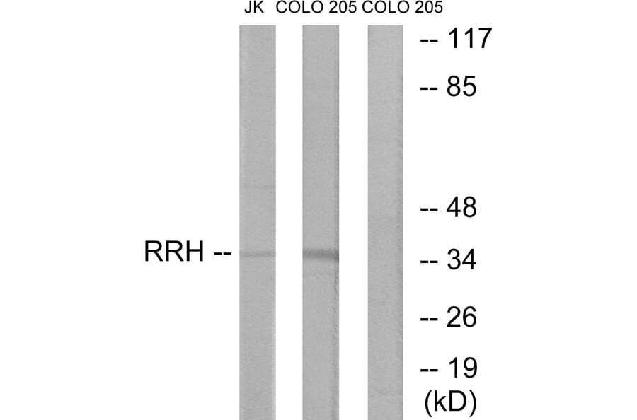 Western Blot - Anti-RRH Antibody (G496) - Antibodies.com