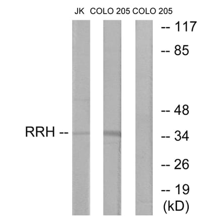 Western Blot - Anti-RRH Antibody (G496) - Antibodies.com