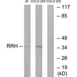 Western Blot - Anti-RRH Antibody (G496) - Antibodies.com