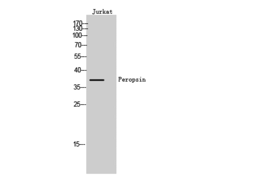 Western Blot - Anti-RRH Antibody (G496) - Antibodies.com