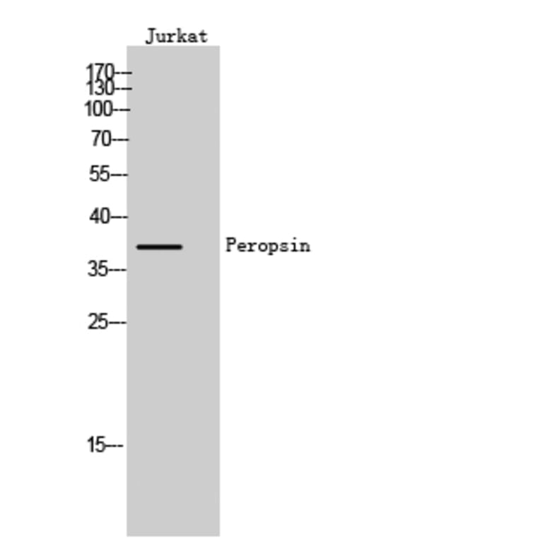 Western Blot - Anti-RRH Antibody (G496) - Antibodies.com