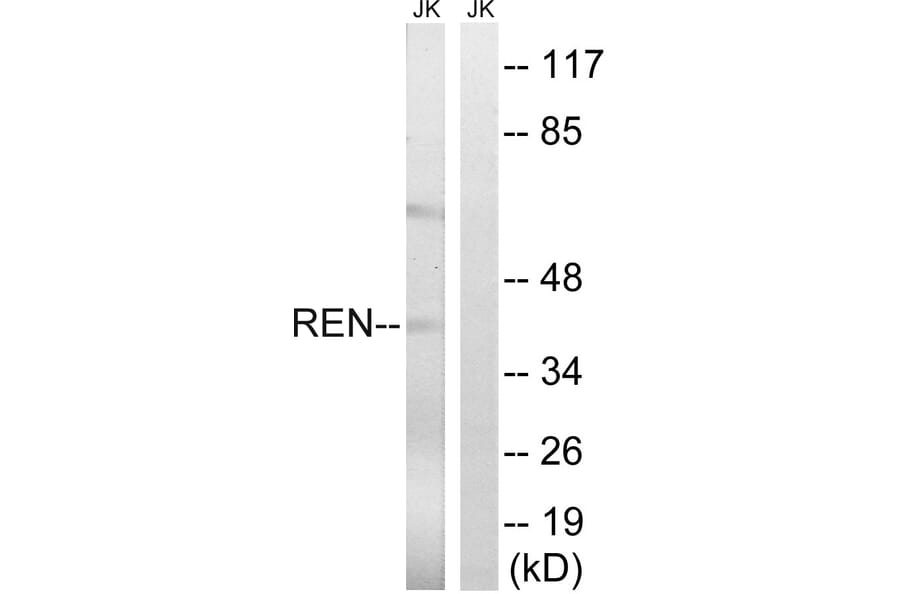 Western Blot - Anti-REN Antibody (C18334) - Antibodies.com