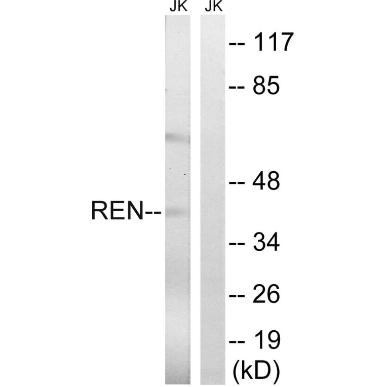 Western Blot - Anti-REN Antibody (C18334) - Antibodies.com