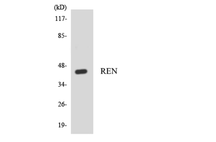 Western Blot - Anti-REN Antibody (R12-3419) - Antibodies.com