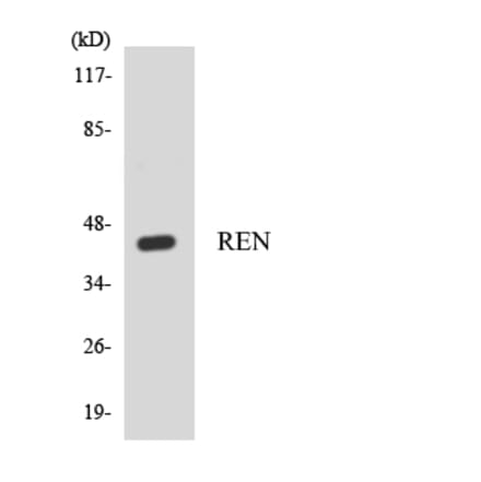 Western Blot - Anti-REN Antibody (R12-3419) - Antibodies.com