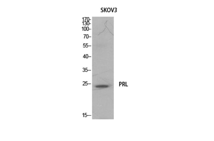 Western Blot - Anti-PRL Antibody (C30310) - Antibodies.com