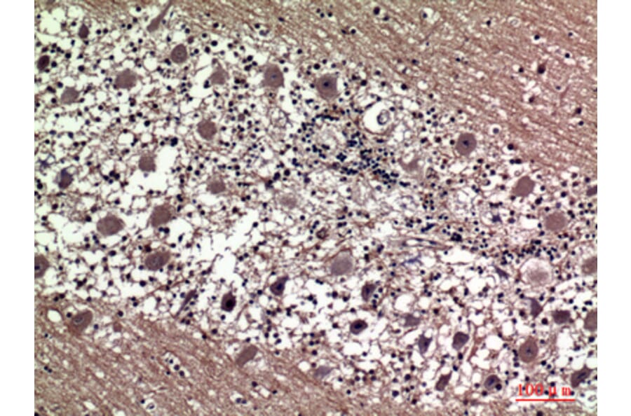 Immunohistochemistry - Anti-PRL Antibody (C30310) - Antibodies.com